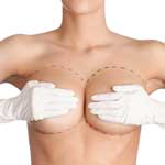 reconstrução de aréola pós mastectomia